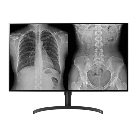 Monitor LG 80 cm (31,5") 32HL512D-B 3840x2160 Medicina IPS 5ms HDMI 2xDisplayPort 2xUSB2.0 Pivot  3H DCI-P3-98% HDR10 Diagnostic 4/6/8MP - CR, CT, Endoscopy